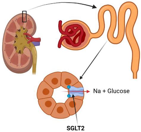 JCM | Free Full-Text | Mechanistic View on the Effects of SGLT2 ...