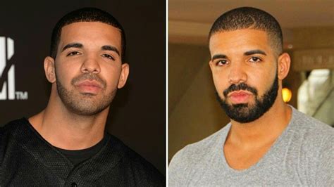 Drake hair transplant 2021