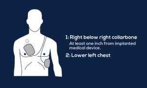 Guide to AED Pad Placement - MDPRO USA