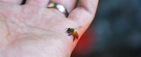 Bee And Wasp Stings: A Go-To Guide | Henry Ford Health - Detroit, MI