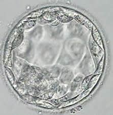 Blastocyst Transfer