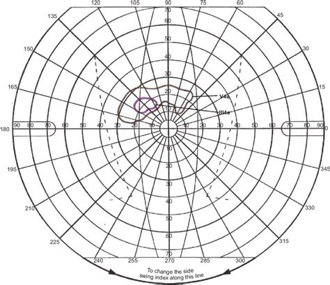 B Goldmann visual field of the left eye at initial examination. | Download Scientific Diagram