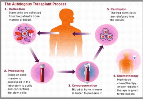 Autologous Stem Cell Transplant Recovery, Success rate « CancerWORLD