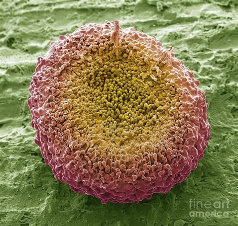 Ascocarp Photograph by Steve Gschmeissner/science Photo Library - Pixels