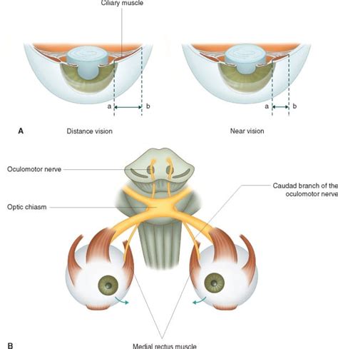 Ocular Accommodation - Refraction - Neurology - Teachmephysiology