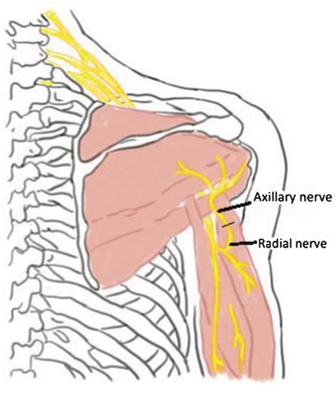 Axillary Nerve Model