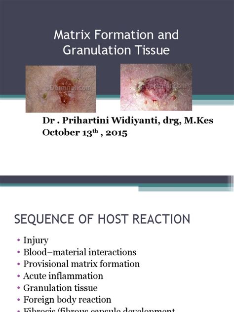 Granulation Tissue 13102015 | Extracellular Matrix | Healing