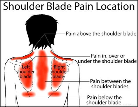 Shoulder Blade Pain Common Causes - Your friendly fashion blog assistant