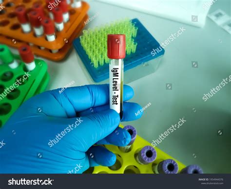 47 Immunoglobulin m Images, Stock Photos & Vectors | Shutterstock