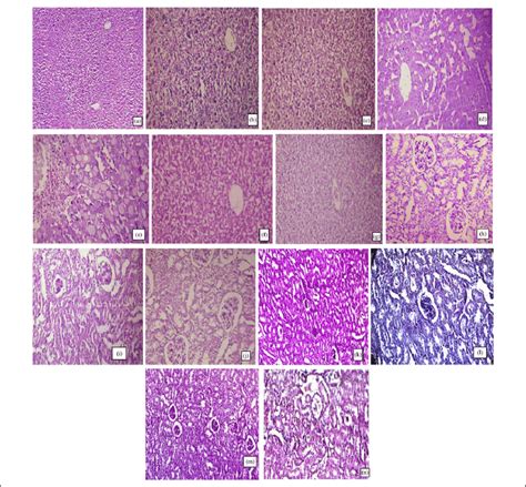 Liver: (a) TS of liver of untreated control mice showing normal... | Download Scientific Diagram