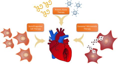 Proposed methods to combat ischemic heart disease (IHD) | Download Scientific Diagram