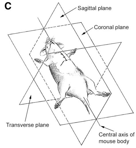 terminology - What is the difference between transverse section and ...