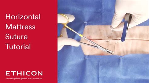 Horizontal Mattress Suture Demonstration | Ethicon - YouTube