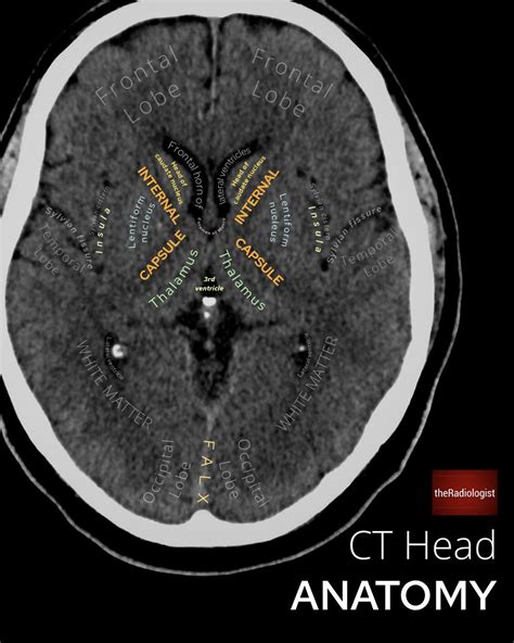 theRadiologist on Twitter: "CT Head anatomy"