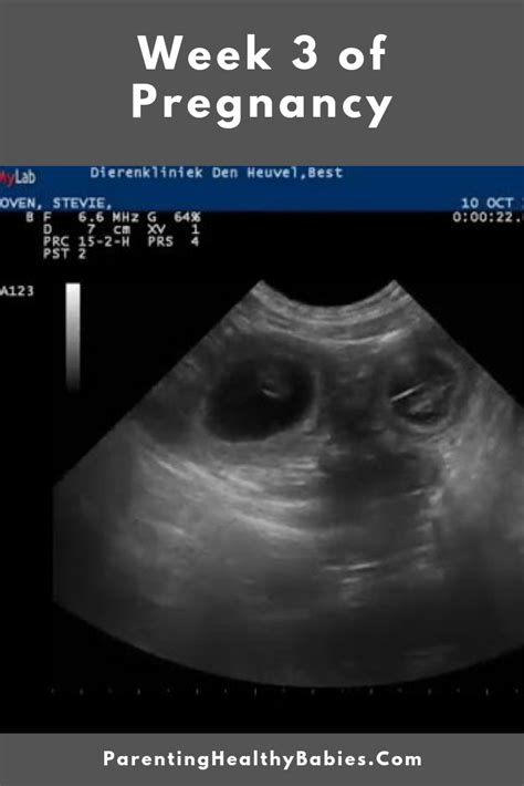 a computer screen with the words, week 3 of pregnant