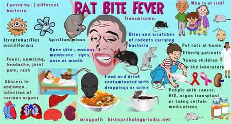 Pathology of Rat Bite Fever - Dr Sampurna Roy MD