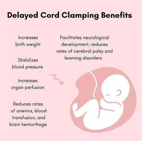 Some fast facts ⤵️ • Delayed cord clamping is especially beneficial for premature infants. • You ...