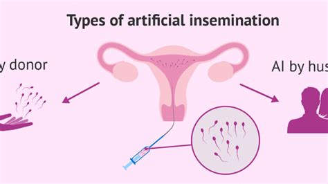 Artificial Insemination Cost | Best Low Cost IVF 2021