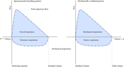 Interpreting the shape of the flow-volume loop | Deranged Physiology