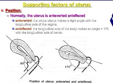 Retroverted retroflexed uterus &uterine inversion