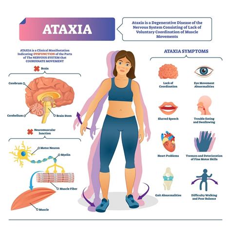 Cerebellar Ataxia and Exercise – Vision Health