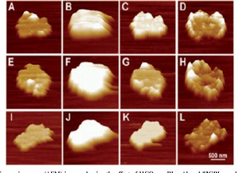 Figure 1 from The annexin A5-mediated pathogenic mechanism in the ...