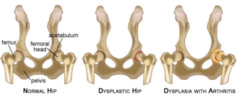 Hip Dysplasia in Dogs