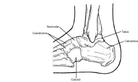 Tarsal Coalition - Foot and Ankle Specialists of Middle Tennessee