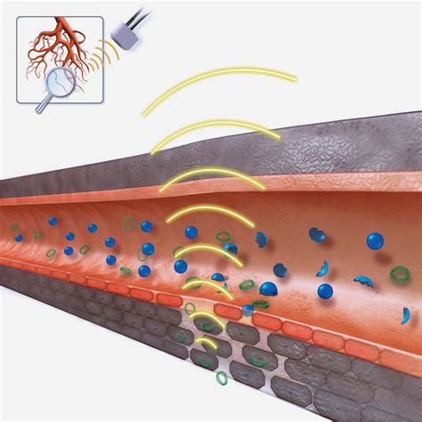 Science online: Mechanical waves and some technological applications of sound mechanical waves