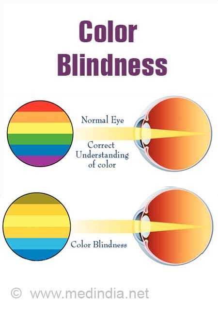 How To Correct Color Blindness - Resolutionrecognition4