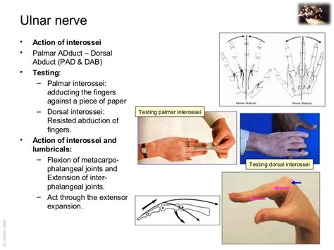 Applied anatomy ulnar nerve injury