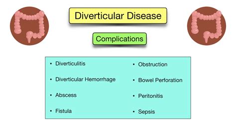 Diverticular Disease: Diverticulitis vs Diverticulosis - Symptoms, Diet ...