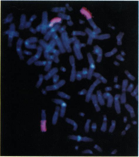 Homogeneously staining regions detected by FISH of metaphase... | Download Scientific Diagram