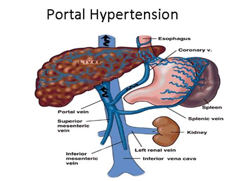 Dr. Abhishekh - Portal hypertension specialist in Gurgaon