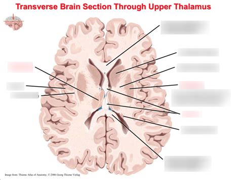 Transverse Brain Section through Upper Thalamus Diagram | Quizlet