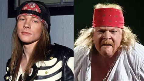 Axl Rose’s Plastic Surgery: The Guns N’ Roses Star Looks Unnatural!