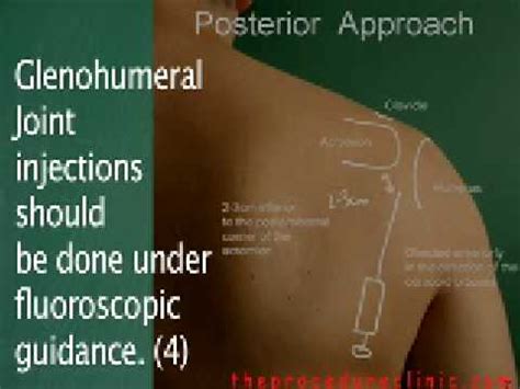 Glenohumeral Shoulder Joint Injection - YouTube