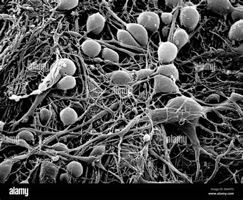 Nerve Cell Electron Microscope