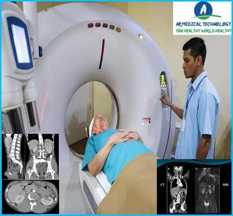 MRI Vs CT Scan Abdomen Best Way To Learn 24