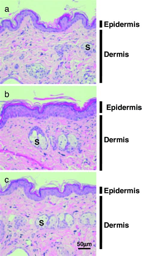 Mouse Skin Histology