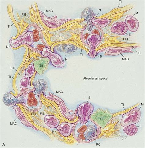 Interstitial Lung Diseases | Clinical Gate