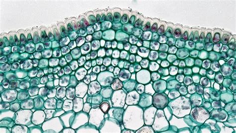 Woody Dicot Stem: Dermal Tissues in Early First Year Tilia | Bio art, Tissue, Stem