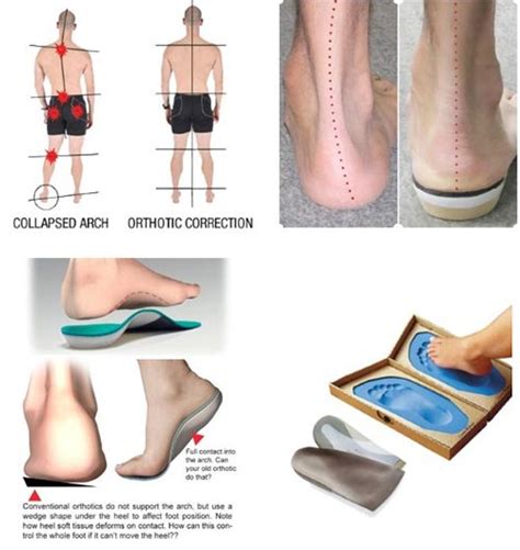 Custom Orthotics Specialists in NYC | Manhattan Foot Specialists