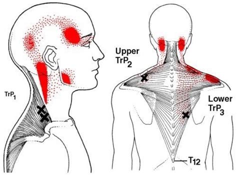 Deep Dive: Neck Pain — Encompass Wellness Studio