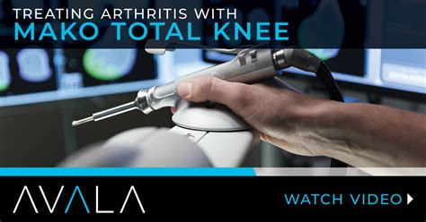 Robotic Knee Surgery Video - AVALA