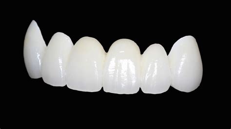 What are Zirconia Crowns? - Magnolia Dental