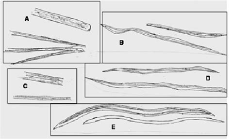 Fibers of the Genus Khaya . (Powdered bark sample). A: Khaya ivoriensis... | Download Scientific ...