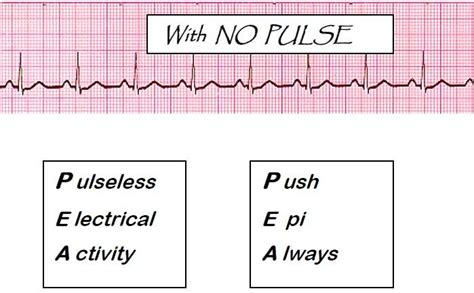 PEA Push Epi Always | Nurse, Pi a, Cardiovascular