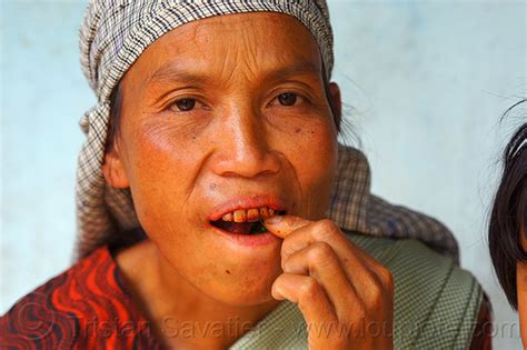 Khasi Woman - Betel Nut Teeth (India)