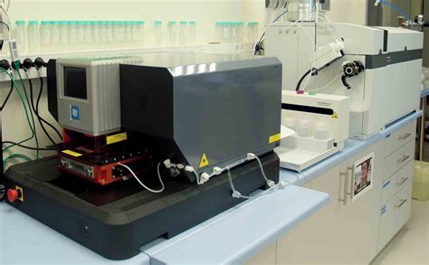 Inductively coupled plasma mass spectrometry (LA-ICP-MS) – IKER